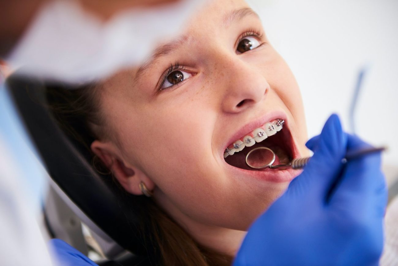 What to Know About Orthodontics Cockeysville, MD Orthodontist